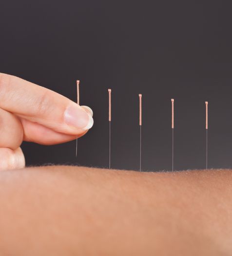Kvalitetna akupunktura v Obalno-kraška