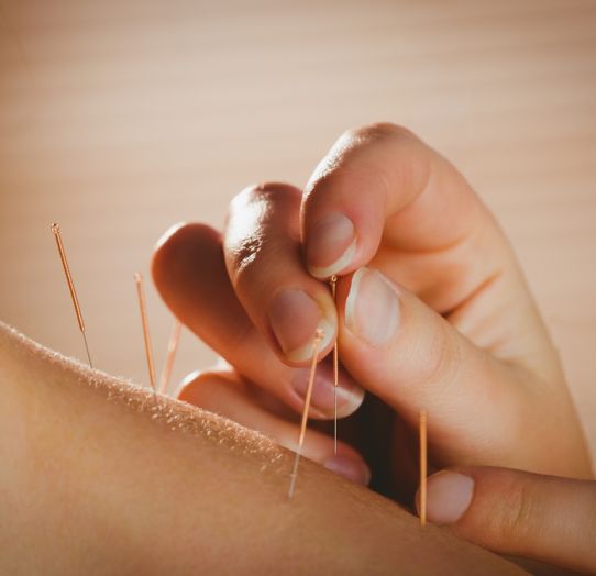 Ugodna medicinska akupunktura