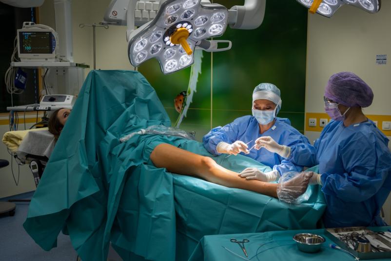 Lasersko odstranjevanje krčnih žil