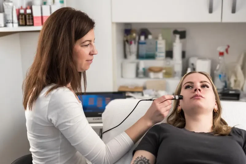 Microneedling Škofja Loka, Gorenjska