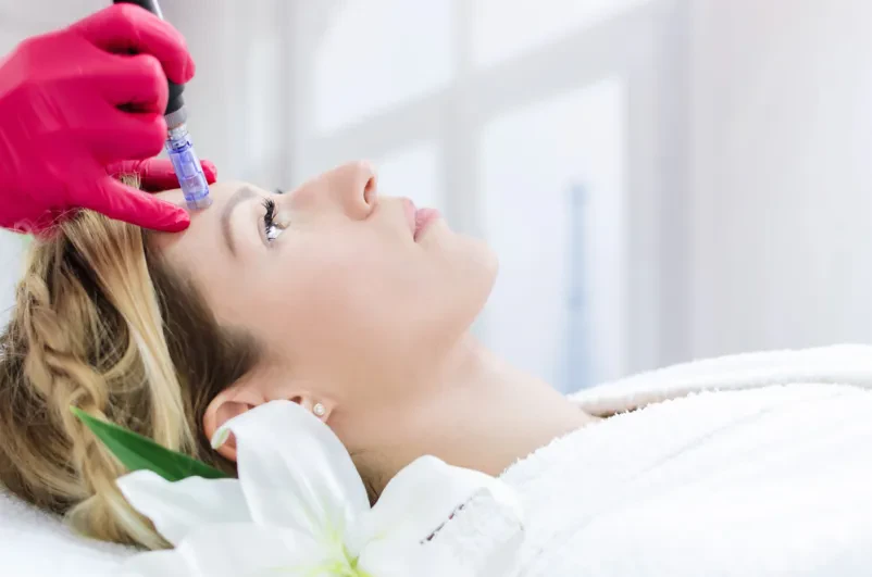SQT Bio Microneedling, kisikove nege in limfna drenaža