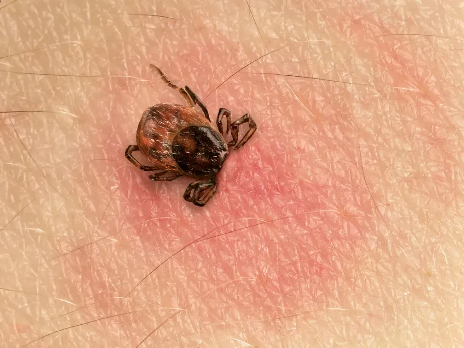 Ugriznil vas je klop – kako ravnati naprej?
