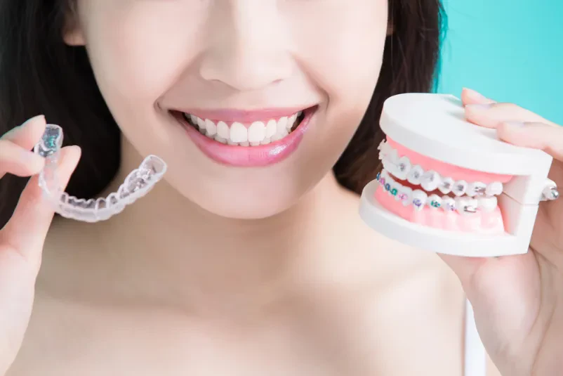 Ugoden invisalign Slovenija