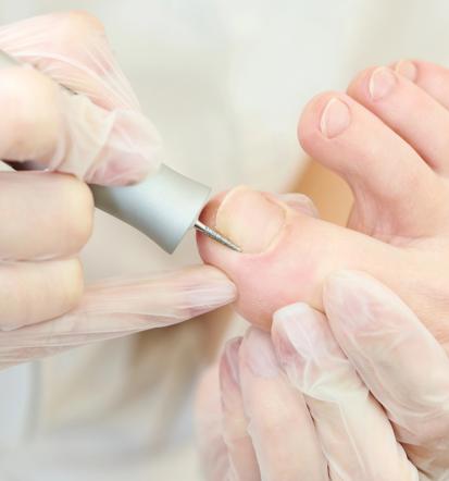 Ugodna medicinska pedikura Gorenjska