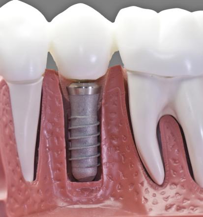 Obiščite dentalni studio Sani Dental d.o.o.