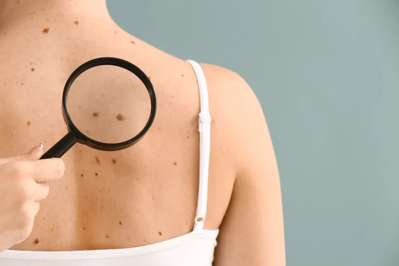 Dermatologija Primorska, obiščite nas