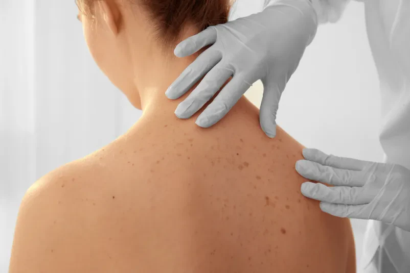 Dermatolog Obala