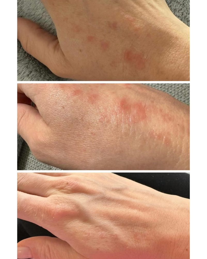 Na najboljšo nego obraza pridite v salon lepote DERMAESTETIK 