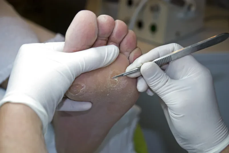 Se želite naučiti profesionalne medicinske pedikure?