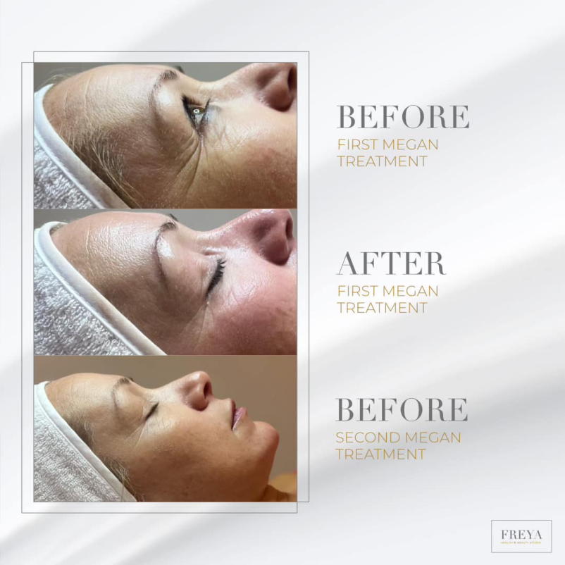 Profesionalna nega obraza Osrednjeslovenska