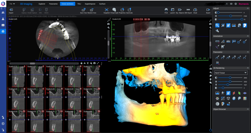Ugoden implantat Ljubljana, Osrednja Slovenija