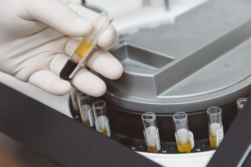 Ambulanta medicine dela Ptuj, pregled pred zaposlitvijo