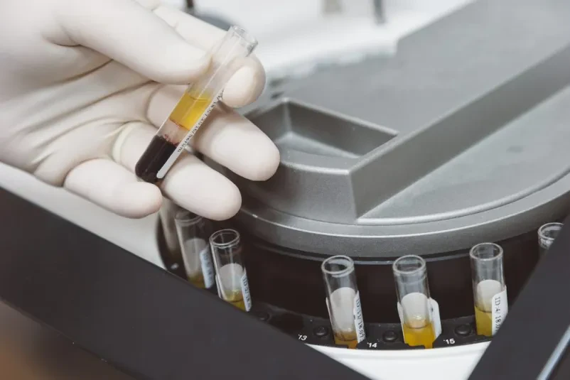 Ambulanta medicine dela, pregled pred zaposlitvijo Ptuj