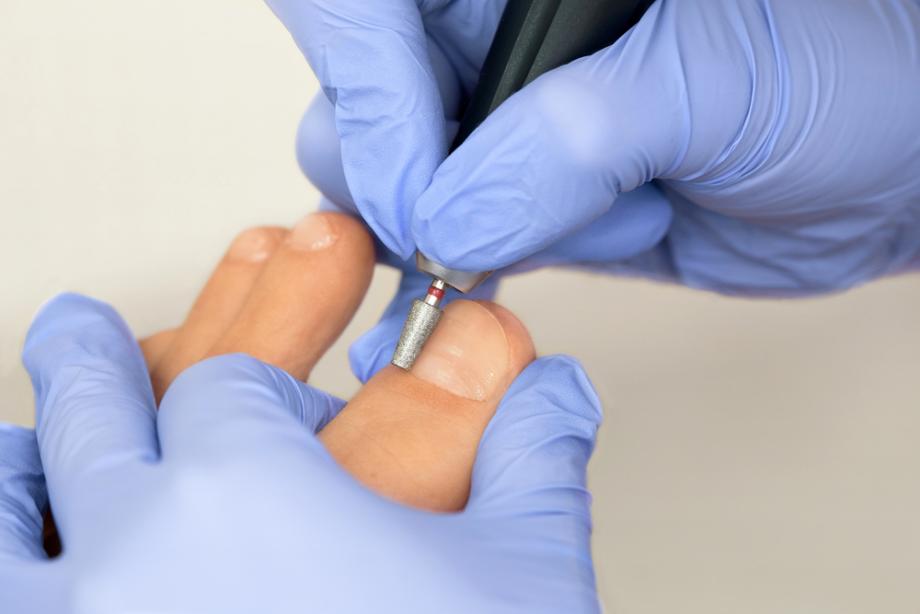 Medicinski postopek, v katerem dobra pedikura preoblikuje občutek stopal