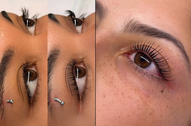 Vihanje trepalnic Grosuplje, Osrednja Slovenija