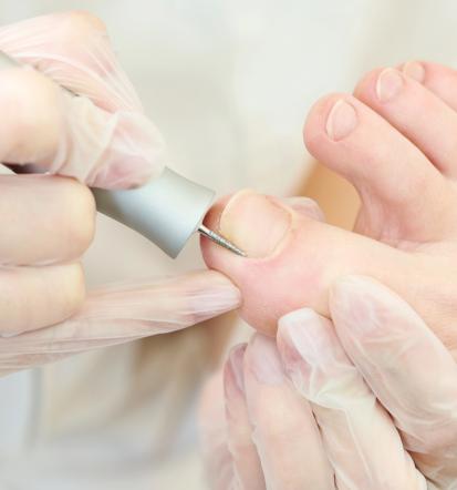 Kvalitetna medicinska pedikura Posavje