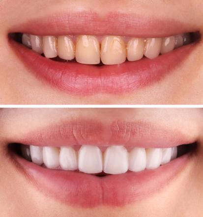 Aniodent, učinkovita in nežna naravna zobna pasta iz Slovenije