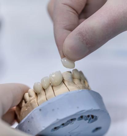 Implantati