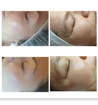 Dober kozmetični salon Podravska, Lahek korak iz Vidma pri Ptuju