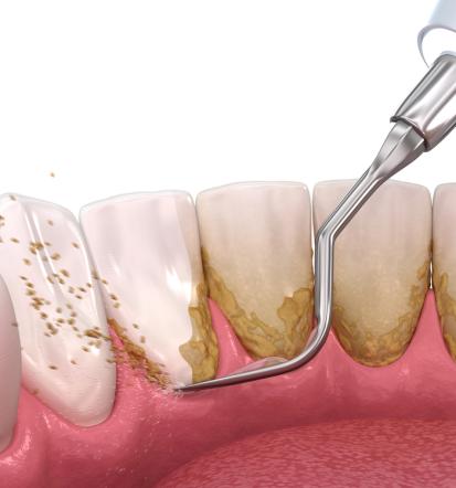 Zobna ordinacija Slovenske Konjice