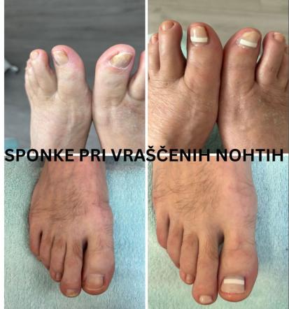 Ugodna pedikura Komenda, Osrednja Slovenija