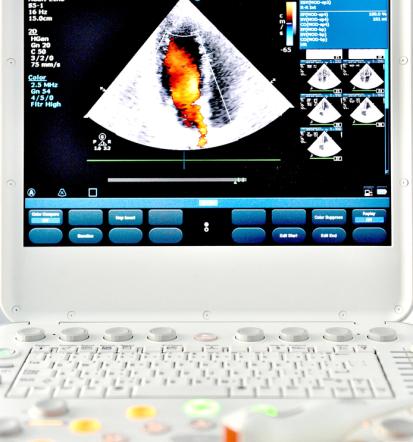 UZ srca, hitro, Ptuj, Štajerska