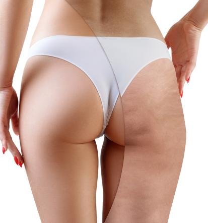 Kvalitetna maderoterapija Maribor