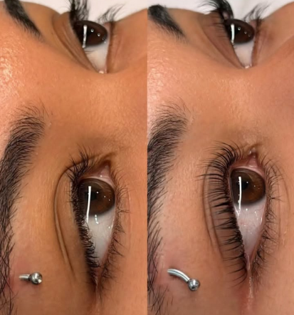 Vihanje trepalnic Grosuplje, Osrednja Slovenija