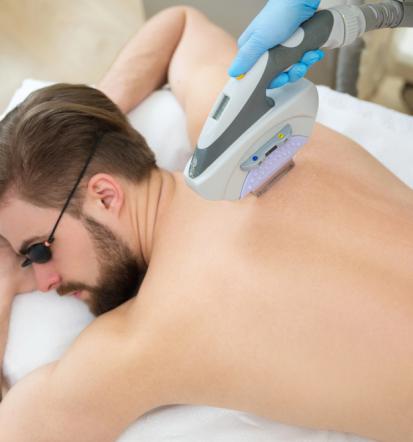 Ugodna laserska depilacija