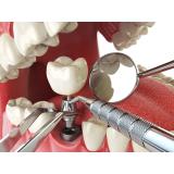 Matevžič Marija Neža - Zobozdravstvo odraslih