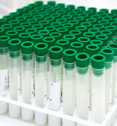 Laboratorijski stol za odvzem krvi