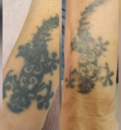 Dober permanentni make-up Kranj za popolne ustnice