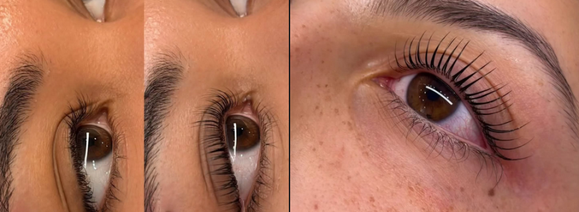 Vihanje trepalnic Grosuplje, Osrednja Slovenija