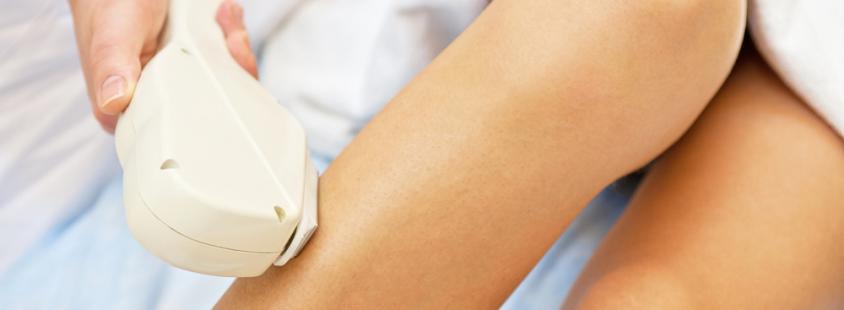 Ugodno lasersko odstranjevanje dlačic Ljubljana, okolica